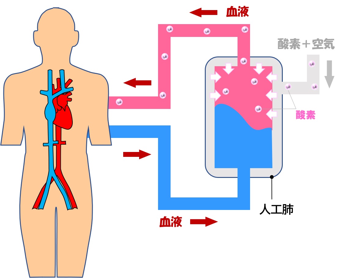 人工心肺装置って | 心臓血管外科医 永吉靖弘